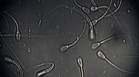 显微镜下的精子