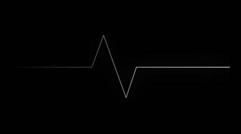 黑色屏幕背景上的心电图生命线